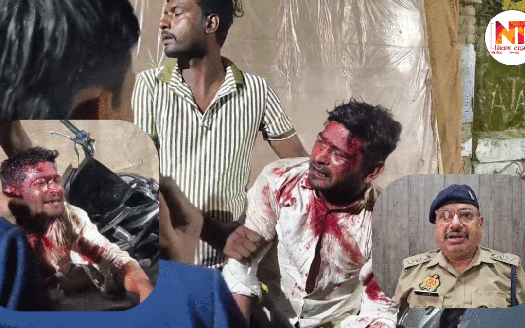 Amroha News: बिरयानी के लेग पीस पर हुआ बवाल, युवक की सरेआम पिटाई, अस्पताल ने भी किया इलाज से इंकार